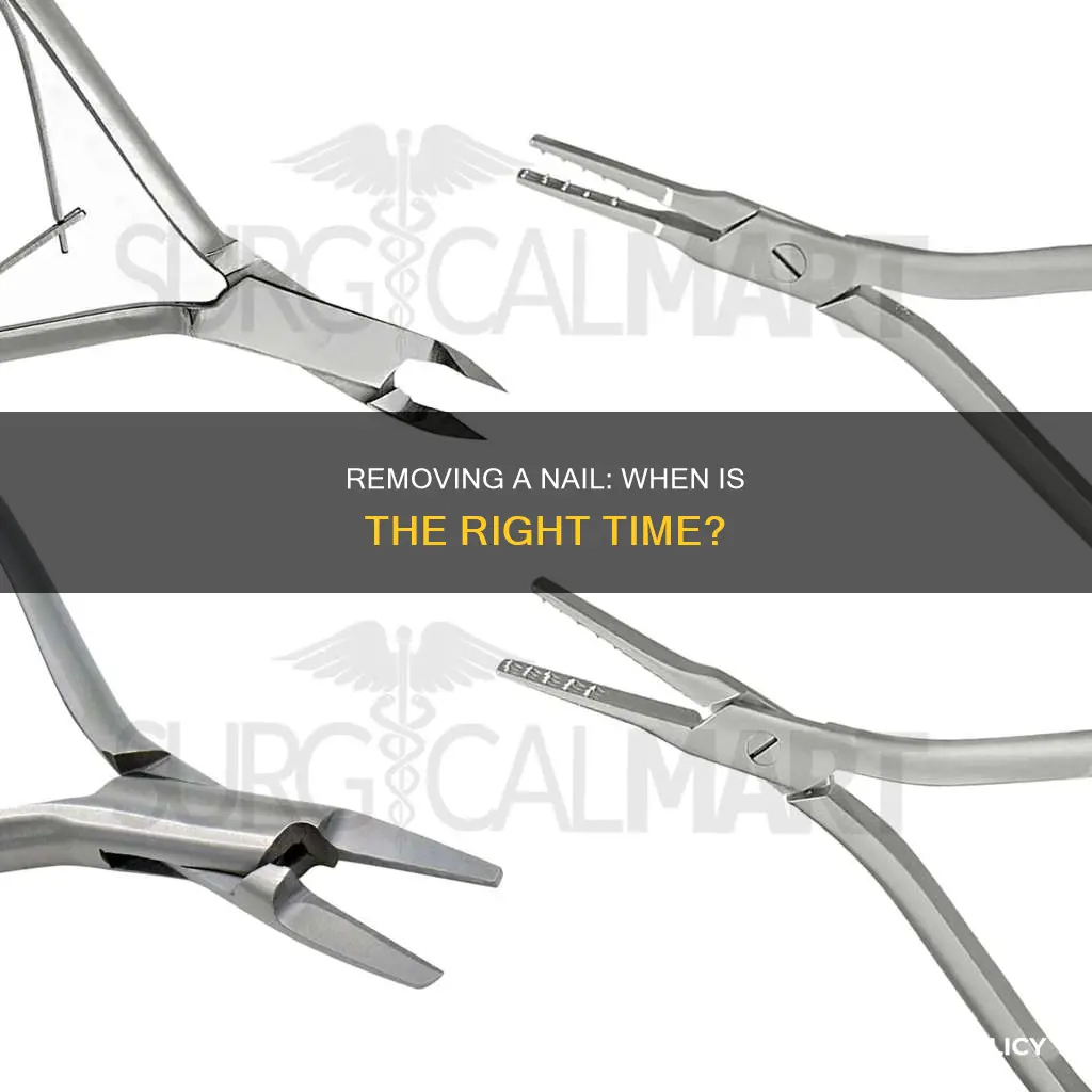 when should you remove a nail