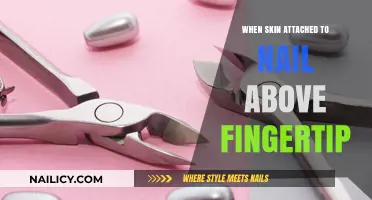 Understanding Eponychium: The Skin Attached to Your Fingernail