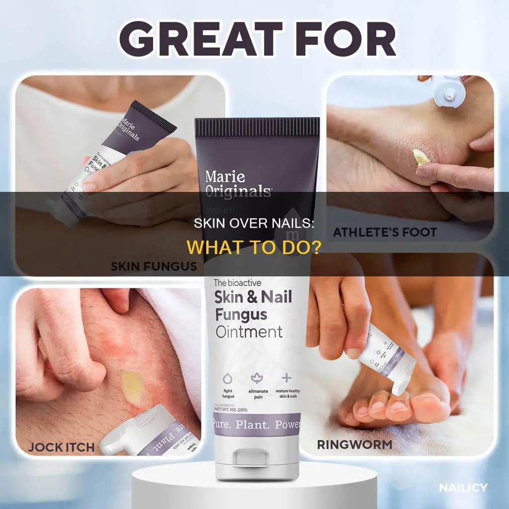 when skin grow over nail