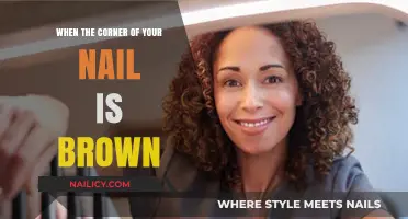 Brown Nail Corner: Causes, Concerns, and Treatment Options Explained