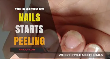 Why Your Skin Under Nails Peels: Causes and Solutions