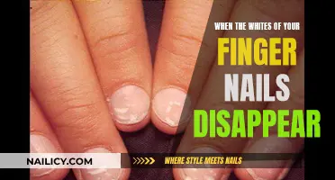 Nail Discoloration: Understanding the Disappearing White of Your Fingernails