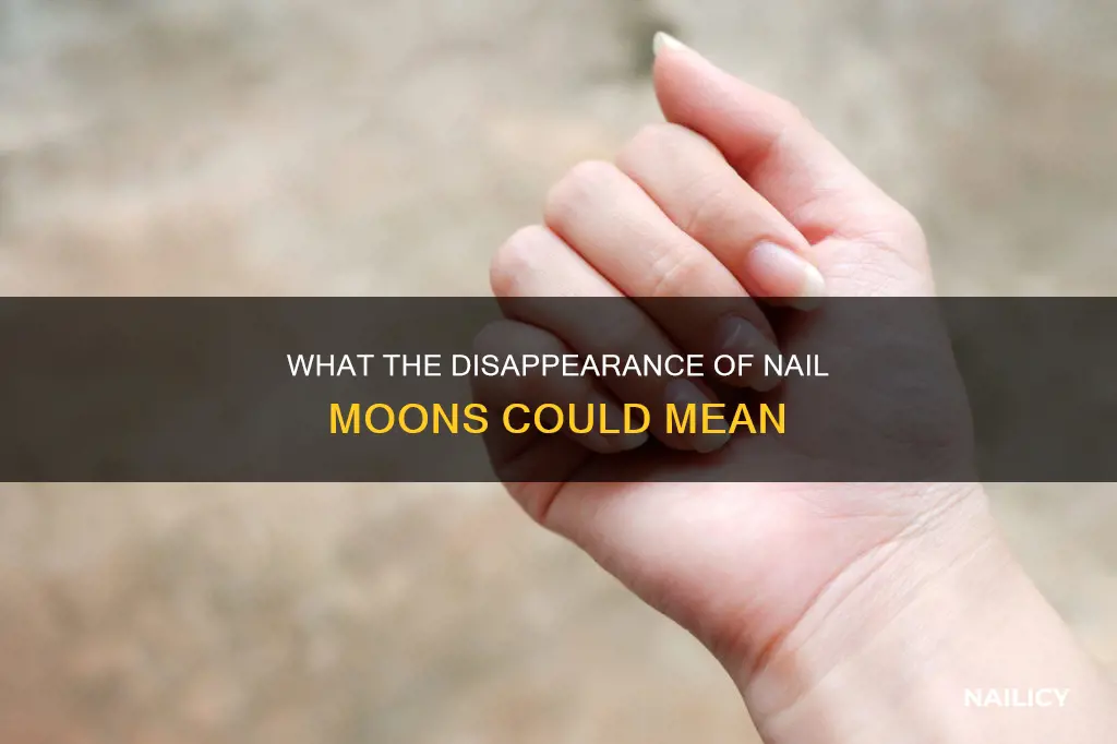 when the whites of your finger nails disappear