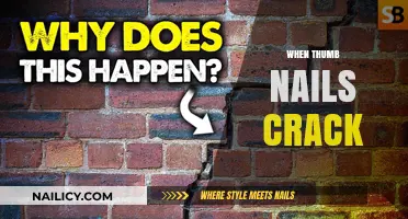 Why Thumbnails Crack: Causes, Prevention, and Effective Treatment Solutions