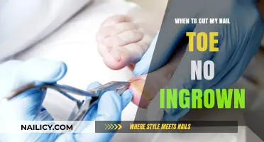Toe Nail Care: Preventing Ingrown Nails