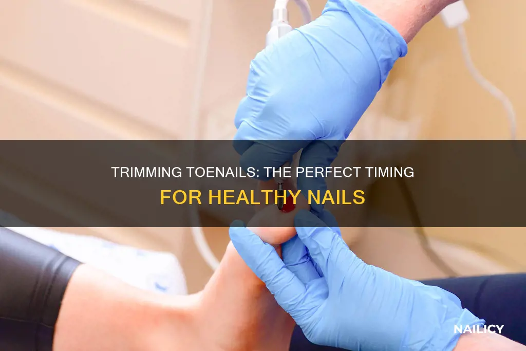 when to cut my nail toe