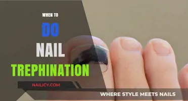 When to Perform Nail Trephination: Essential Timing for Effective Relief