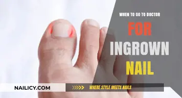 Ingrown Nail Pain: When to Seek Medical Help and Treatment