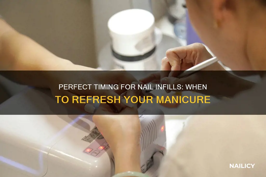 when to infill nails