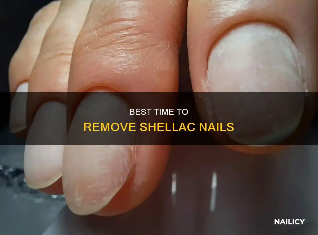 when to remove shellac nails