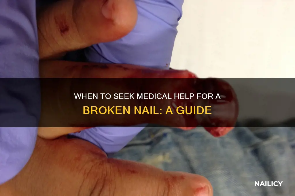 when to see doctor for broken nail