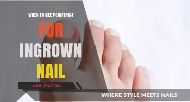 Ingrown Toenail Pain: When to Seek Podiatrist Help