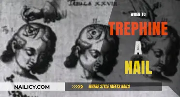 Trephining Toenails: When and Why to Consider This Procedure