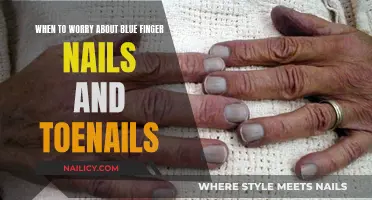 Blue Nails: When to Seek Medical Attention for This Color Change