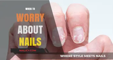 When to Worry About Your Nails: Signs and Symptoms to Watch For