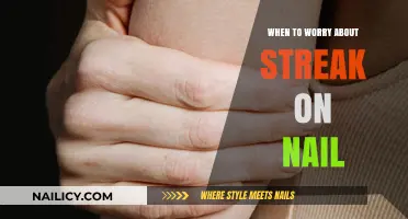 Nail Streaks: When to Worry and Seek Medical Advice