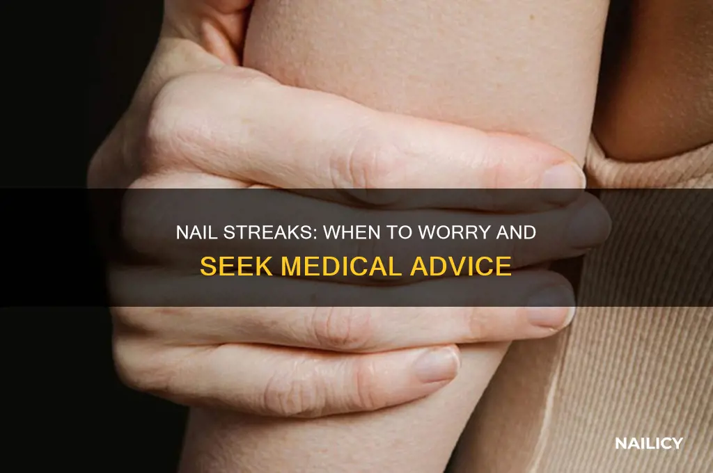 when to worry about streak on nail