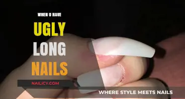 Unsightly Nails: When Long Nails Go Wrong