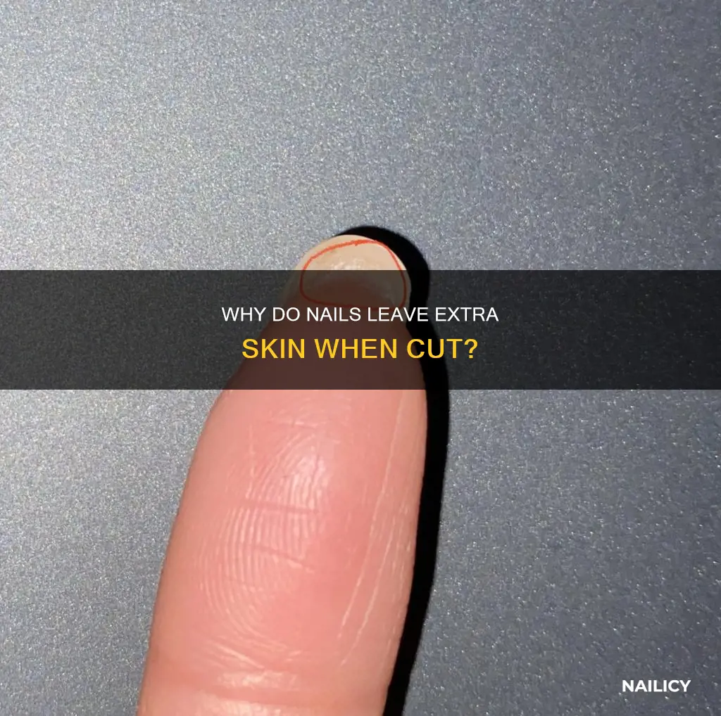 when we cut nails why is there extra skin left