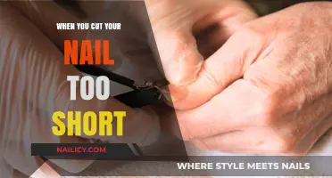 Nail Nightmare: When Trimming Nails Go Wrong