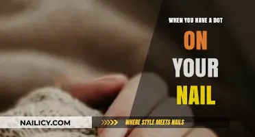 Understanding the Causes and Concerns of a Dot on Your Nail