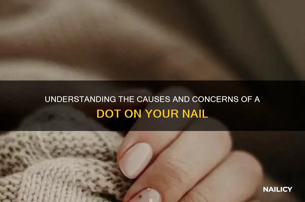 when you have a dot on your nail
