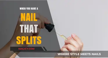 How to Heal and Prevent Split Nails: A Comprehensive Guide