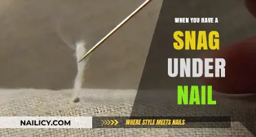 Painful Snag Under Nail: Causes, Remedies, and Prevention Tips
