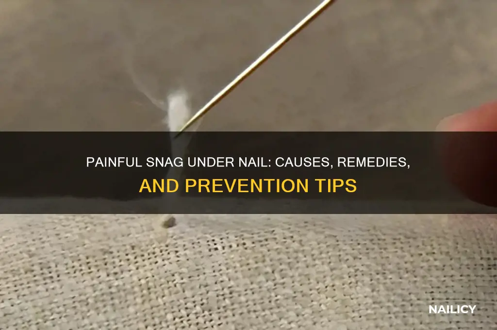 when you have a snag under nail