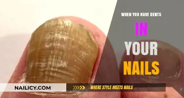 Dented Nails: Causes, Concerns, and Effective Solutions Explained