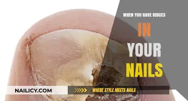 Ridges in Your Nails: Causes, Concerns, and Care Tips