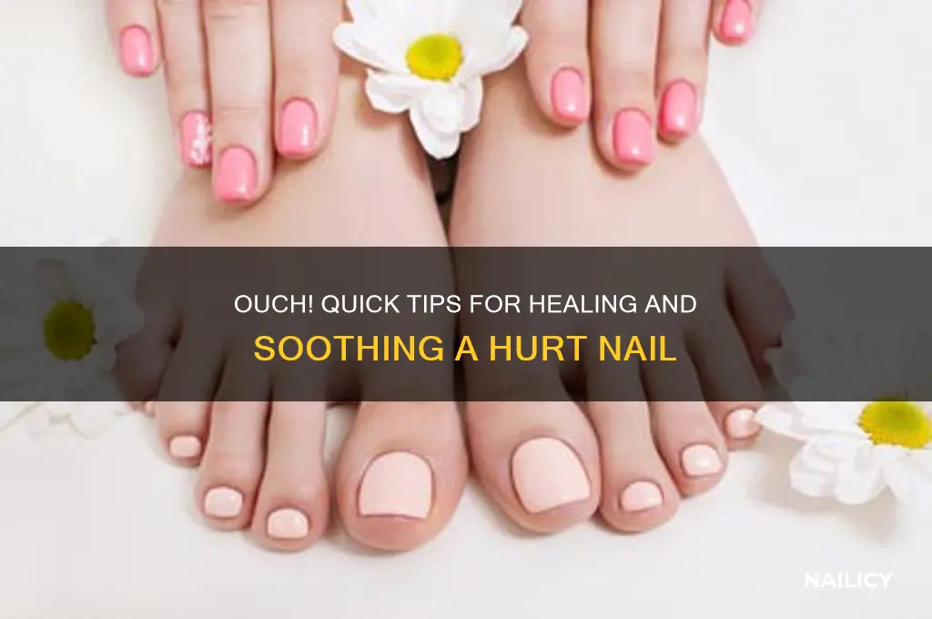 when you hurt your nail
