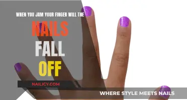 Jamming Your Finger: Will Nails Fall Off?