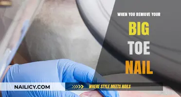 Toe-nail Trauma: A Painful Pedicure Experience