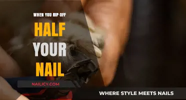 Ouch! How to Heal and Cope When You Rip Off Half Your Nail