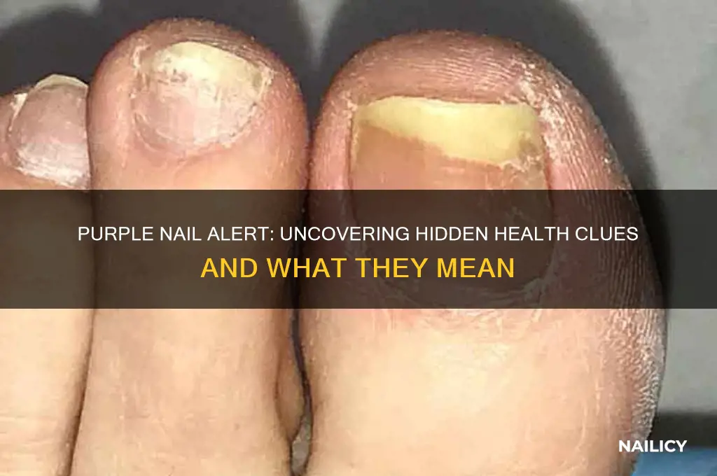 when you see purple nail