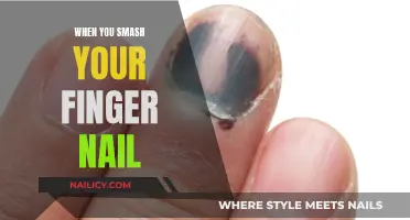 The Painful Art of Breaking a Finger Nail: What to Do Next