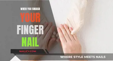 The Agonizing Pain of Smashing Your Fingernail