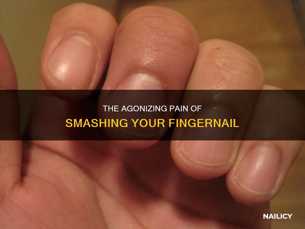 when you smash your finger nail