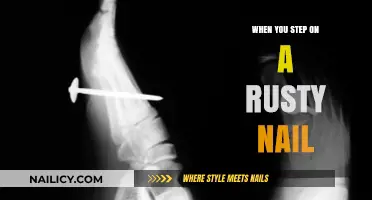 Rusty Nail Risks: What to Do After a Painful Step