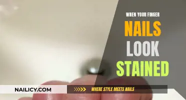 How to Remove Stains from Your Fingernails