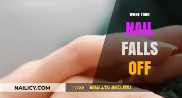 Nail Loss 101: Causes, Care, and Recovery Tips for Healthy Nails