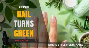 Green Nails: Causes, Concerns, and Quick Remedies Explained