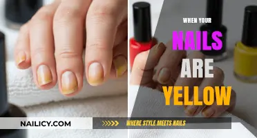 Why Your Nails Are Yellow: Causes, Concerns, and Effective Solutions