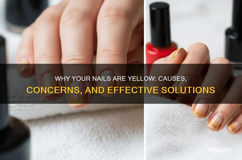 when your nails are yellow