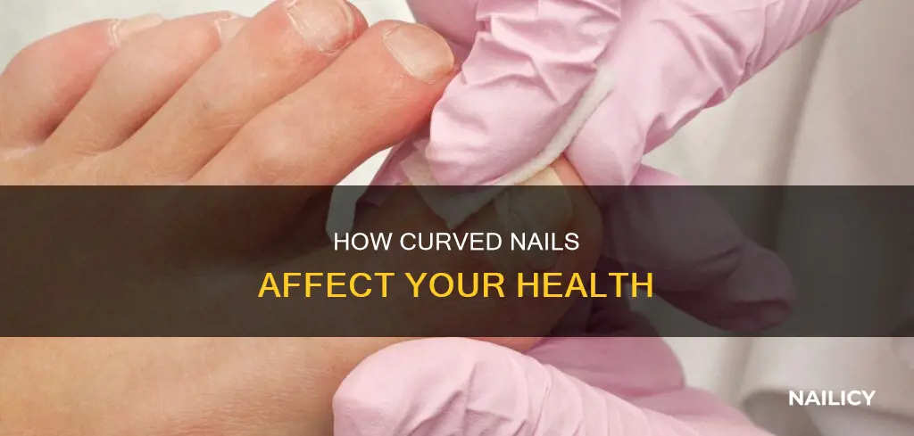 when your nails grow curved