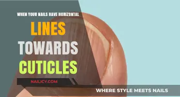 Horizontal Lines on Nails Near Cuticles: Causes and Solutions