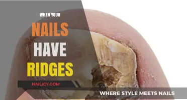 Understanding Ridges on Your Nails: Causes, Concerns, and Care Tips