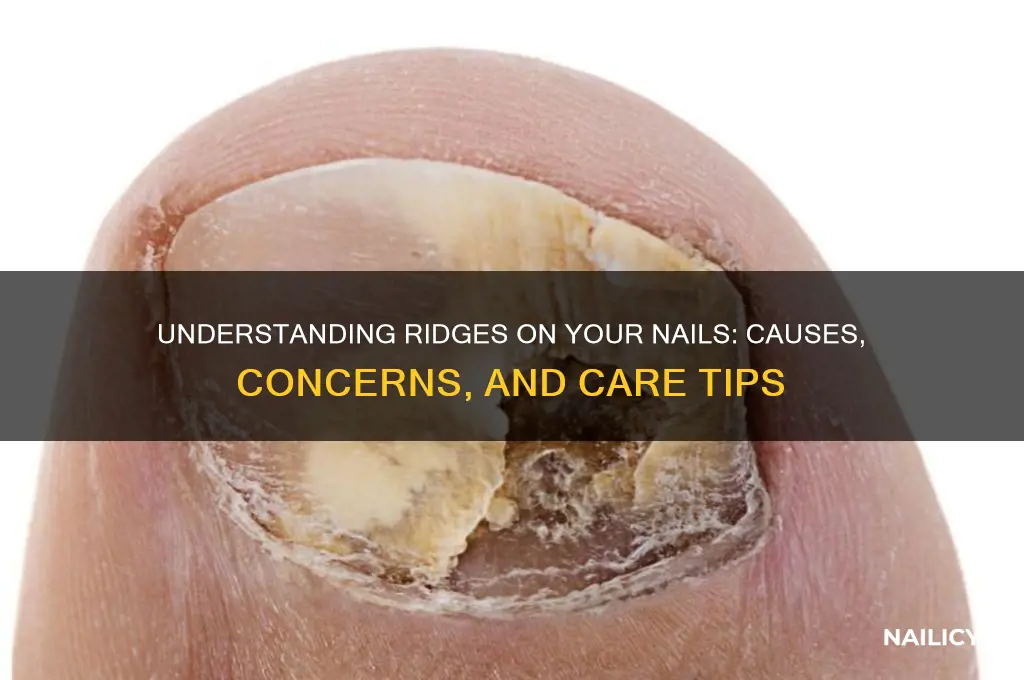 when your nails have ridges