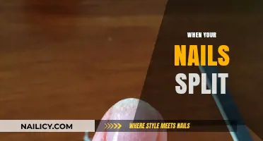 How to Heal and Prevent Split Nails: Expert Tips and Tricks